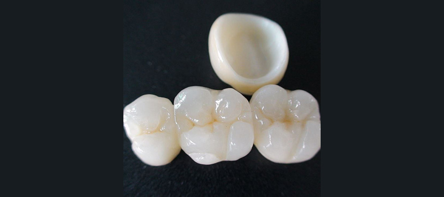 Zirconia capping